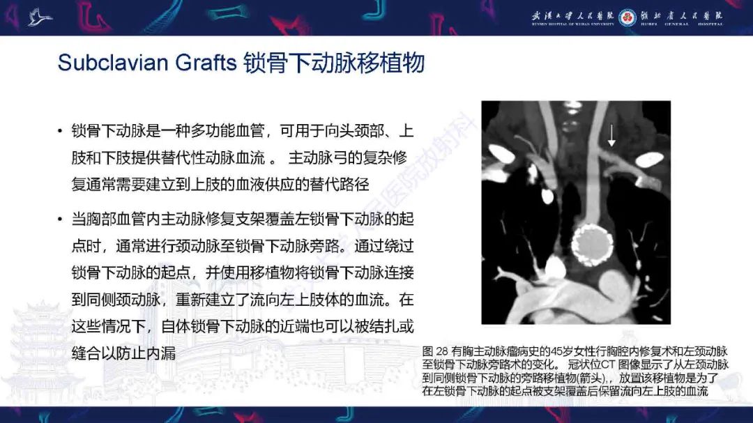 影像PPT - 【PPT】锁骨下动脉正常解剖及病变影像诊断-38
