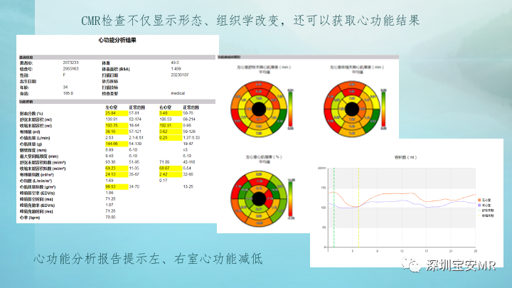 影像PPT - 【PPT】新冠病毒相关心肌炎的磁共振诊断-12