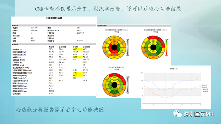 影像PPT - 【PPT】新冠病毒相关心肌炎的磁共振诊断-15