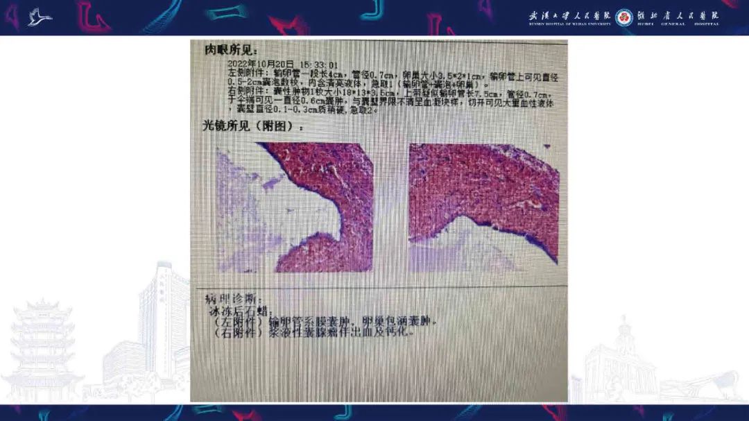 影像PPT - 【PPT】附件扭转影像诊断-17