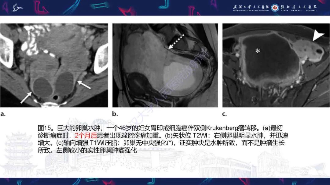 影像PPT - 【PPT】附件扭转影像诊断-30