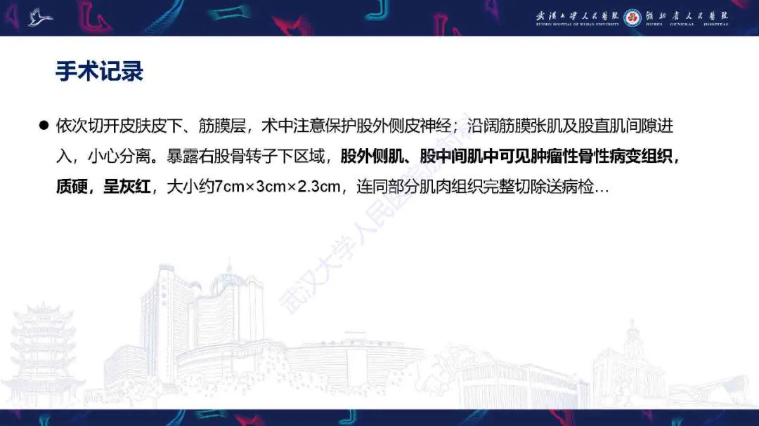 影像PPT - 【PPT】骨化性肌炎影像诊断-4