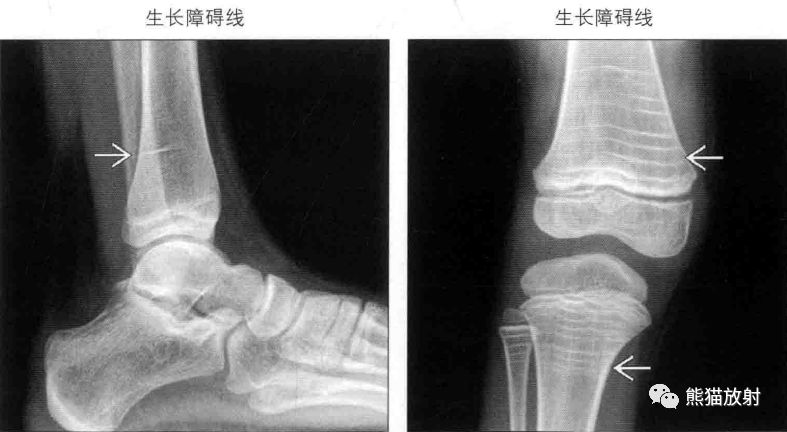 影像PPT - \ 影像PPT - \