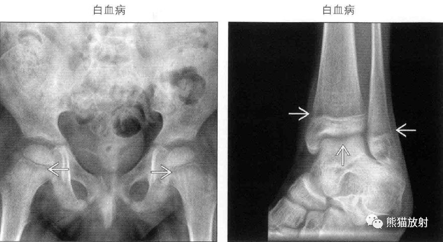 影像PPT - \ 影像PPT - \