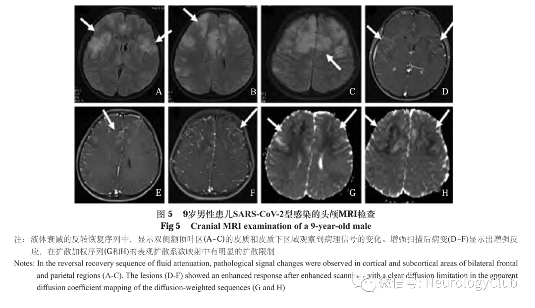 影像PPT - 脑皮质层状坏死的研究进展-5 影像PPT - 脑皮质层状坏死的研究进展-5