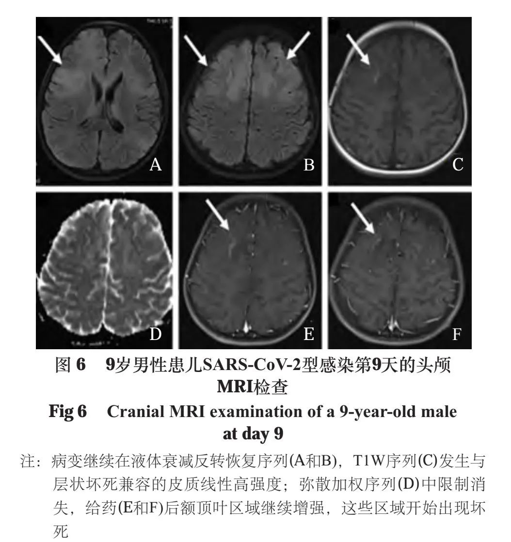 影像PPT - 脑皮质层状坏死的研究进展-6 影像PPT - 脑皮质层状坏死的研究进展-6