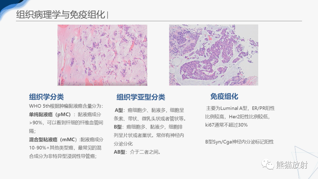 影像PPT - 【病例】乳腺粘液癌2例MR影像-23