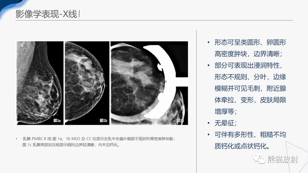 影像PPT - 【病例】乳腺粘液癌2例MR影像-24