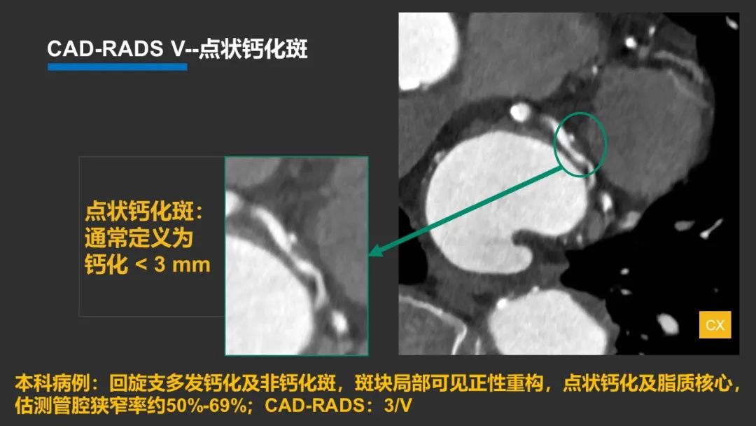 影像PPT - 【PPT】冠脉CAD-RADS分级系统解读-31