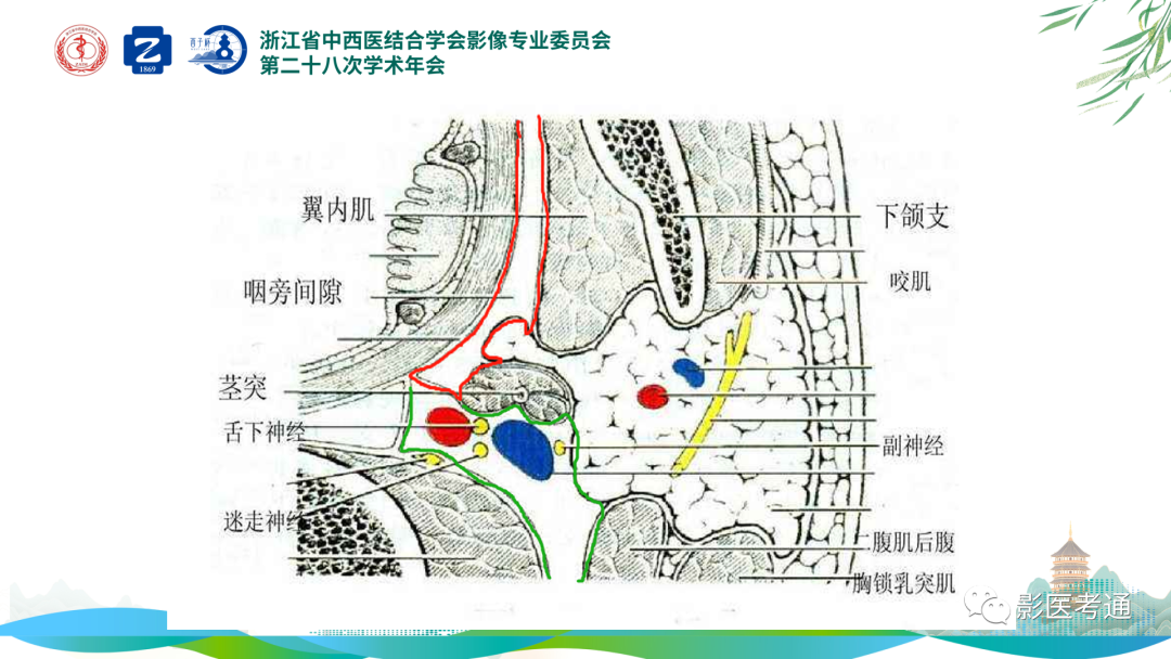 影像PPT - 【PPT】咽旁间隙病变定位与常见肿瘤性病变影像诊断-6 影像PPT - 【PPT】咽旁间隙病变定位与常见肿瘤性病变影像诊断-6