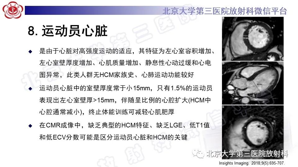 影像PPT - 【PPT】CMR在心肌肥厚中的诊断与鉴别诊断-25