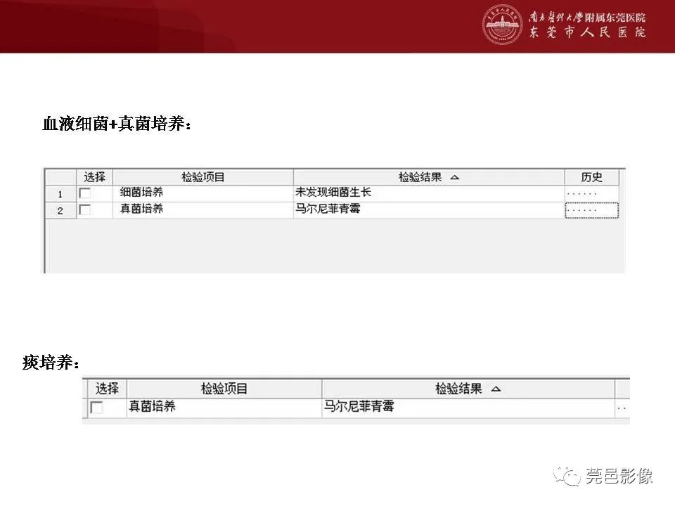 影像PPT - 【病例】马尔尼菲蓝状菌感染累及淋巴结1例CT影像学表现-15