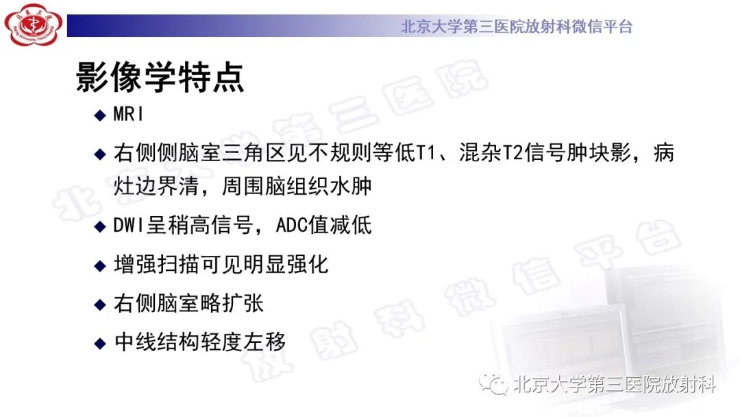 影像PPT - 【PPT】颅内孤立性纤维性肿瘤/血管外皮瘤（SFT/HPC）-7
