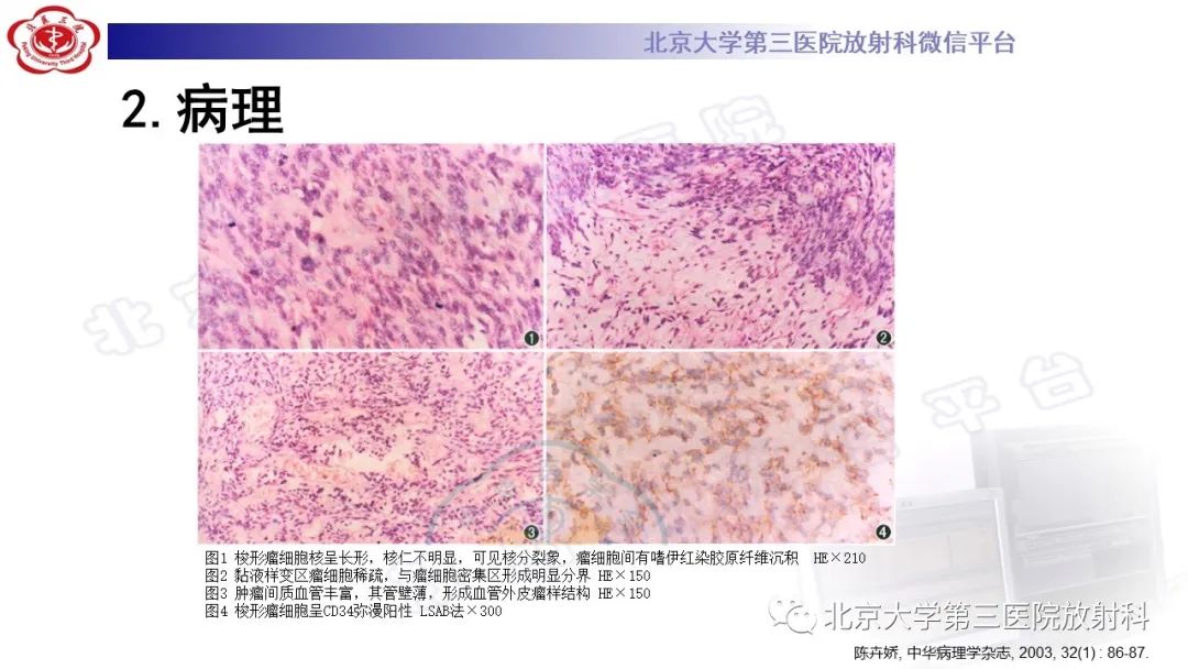 影像PPT - 【PPT】颅内孤立性纤维性肿瘤/血管外皮瘤（SFT/HPC）-14