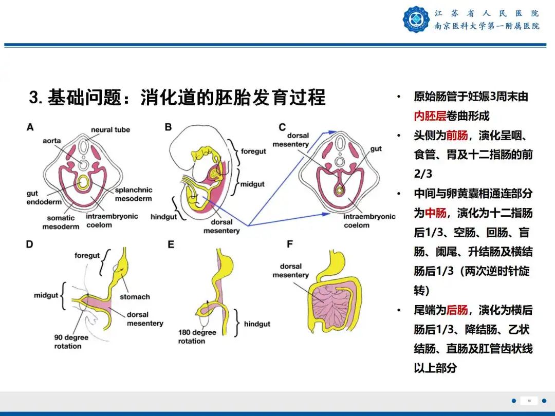 影像PPT - 【PPT】食管闭锁-15