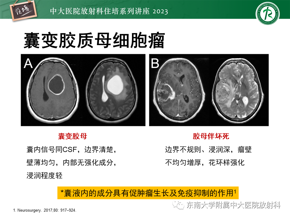 影像PPT - 【PPT】颅内常见肿瘤性囊性病变-10