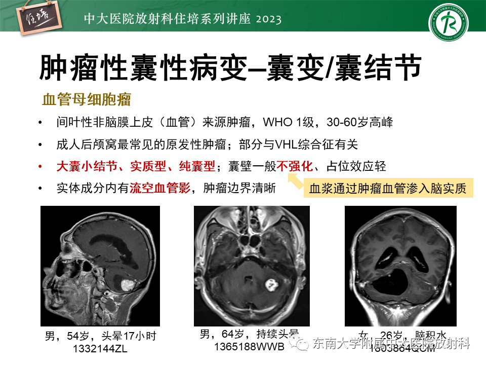 影像PPT - 【PPT】颅内常见肿瘤性囊性病变-11