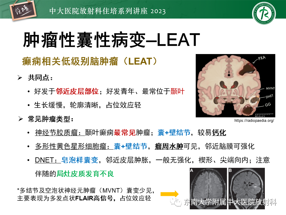 影像PPT - 【PPT】颅内常见肿瘤性囊性病变-18