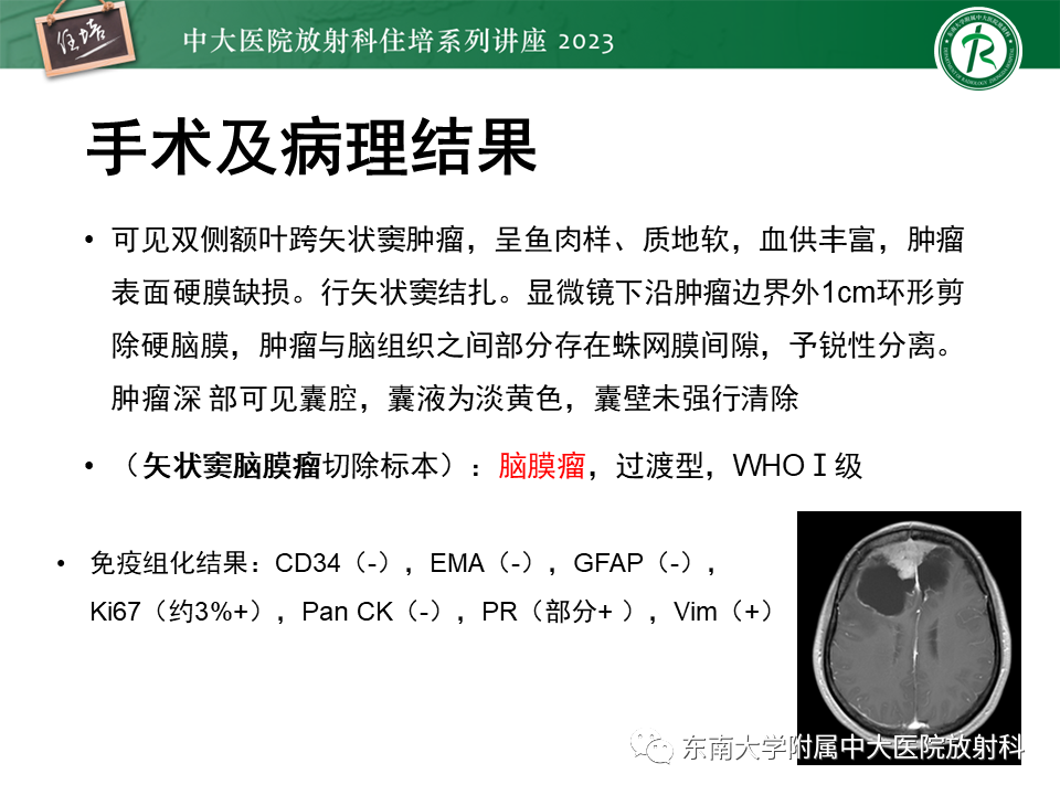 影像PPT - 【PPT】颅内常见肿瘤性囊性病变-27
