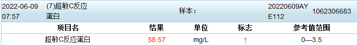 影像PPT - 【病例】特鲁索综合征2例CT及MR影像-2 影像PPT - 【病例】特鲁索综合征2例CT及MR影像-2