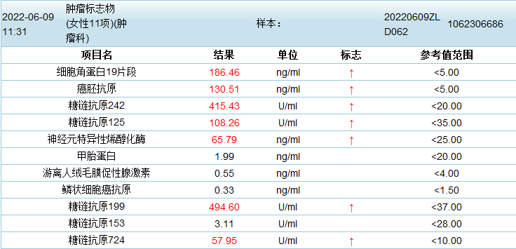 影像PPT - 【病例】特鲁索综合征2例CT及MR影像-1 影像PPT - 【病例】特鲁索综合征2例CT及MR影像-1