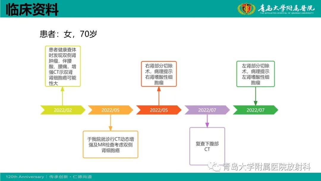 影像PPT - 【病例】肾脏嗜酸性细胞腺瘤1例CT影像-10