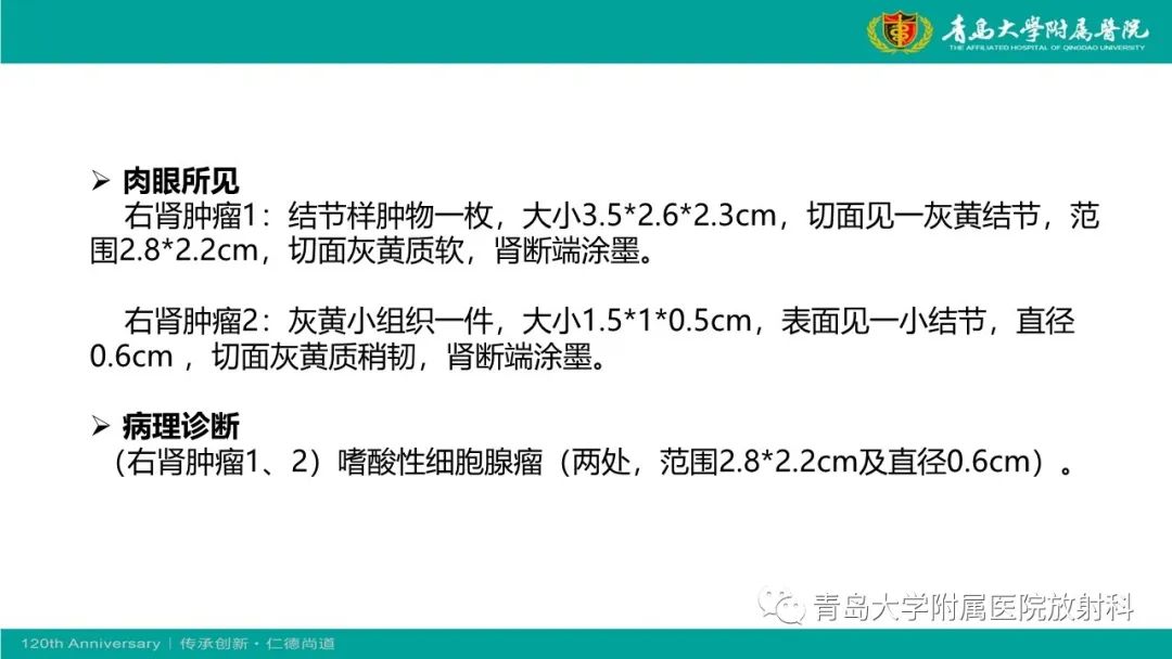 影像PPT - 【病例】肾脏嗜酸性细胞腺瘤1例CT影像-11