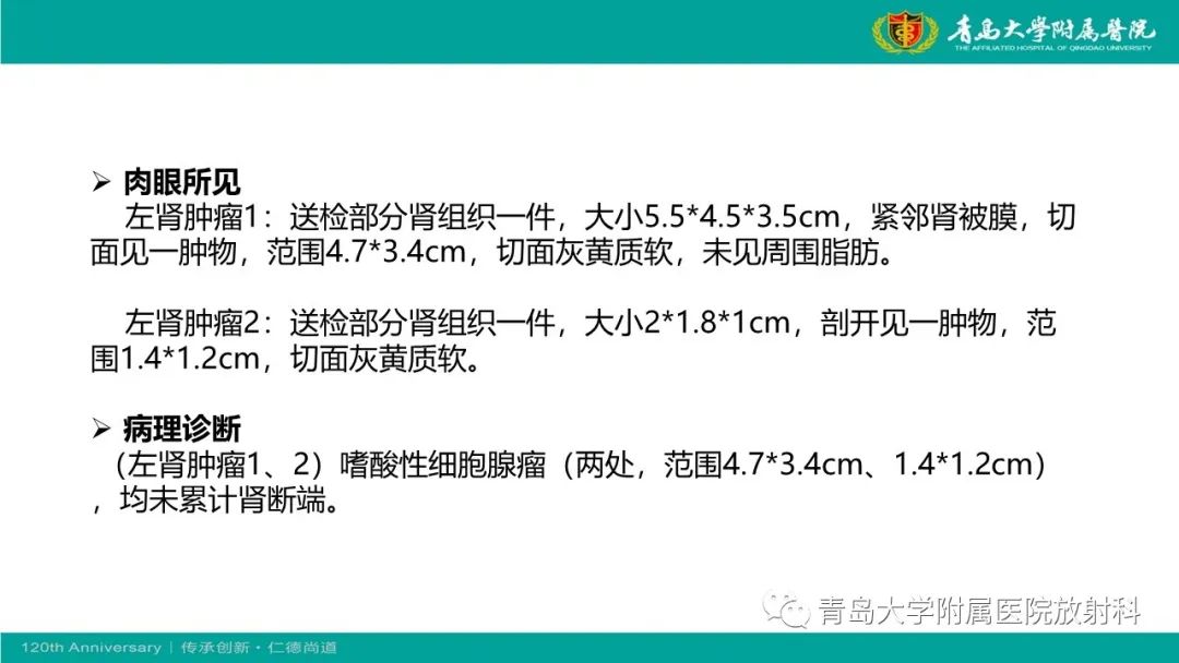 影像PPT - 【病例】肾脏嗜酸性细胞腺瘤1例CT影像-12