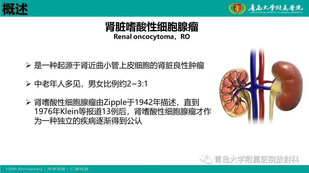 影像PPT - 【病例】肾脏嗜酸性细胞腺瘤1例CT影像-13
