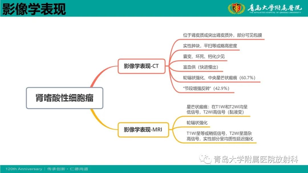 影像PPT - 【病例】肾脏嗜酸性细胞腺瘤1例CT影像-16
