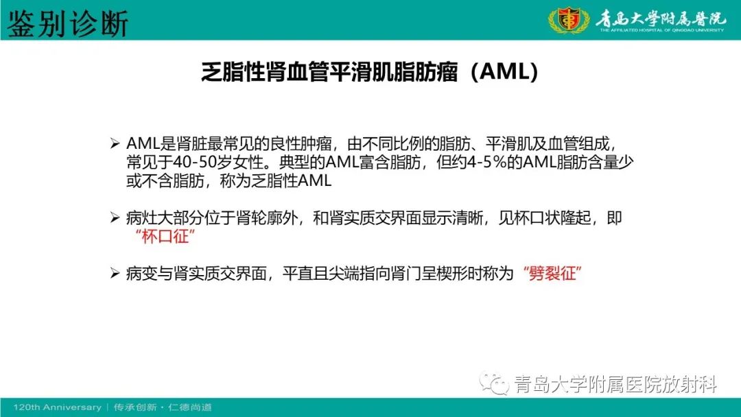 影像PPT - 【病例】肾脏嗜酸性细胞腺瘤1例CT影像-29