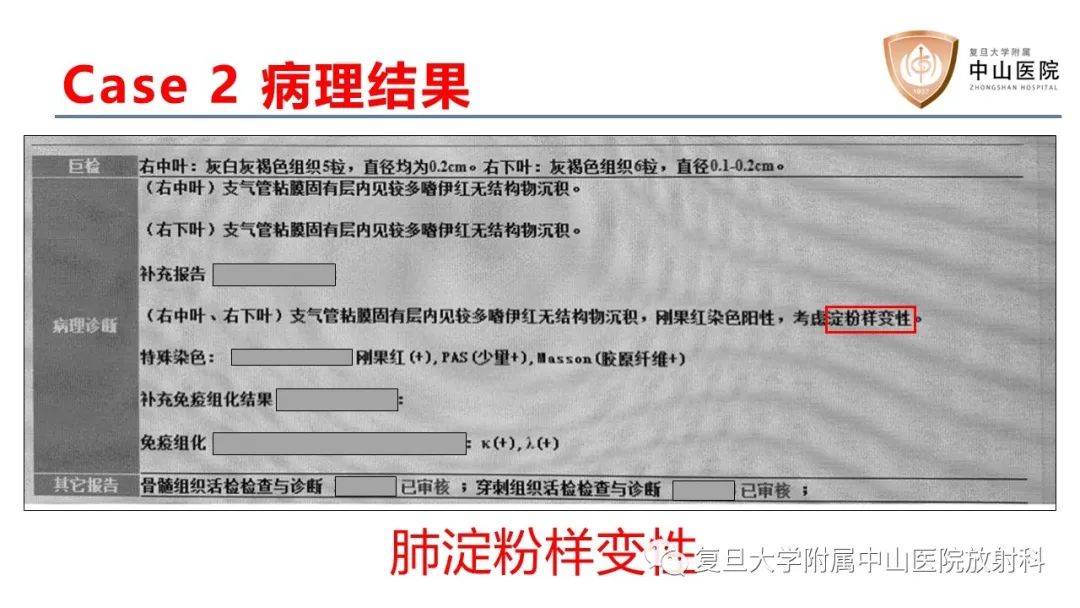 影像PPT - 【病例】肺淀粉样变性2例CT影像-8