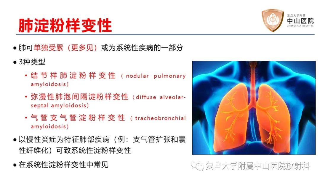 影像PPT - 【病例】肺淀粉样变性2例CT影像-12