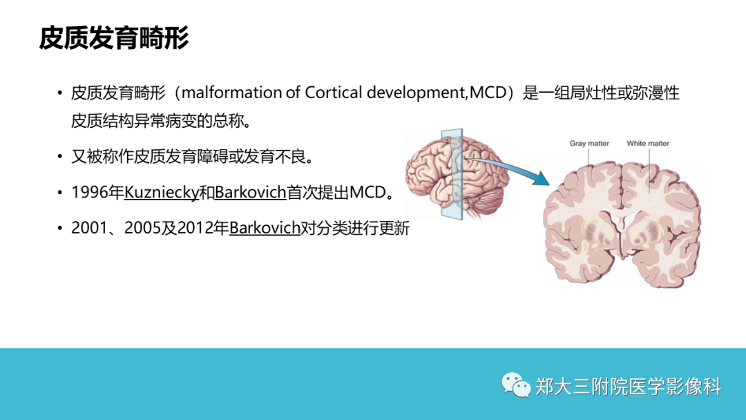 影像PPT - 【PPT】儿童皮层发育畸形影像诊断-2