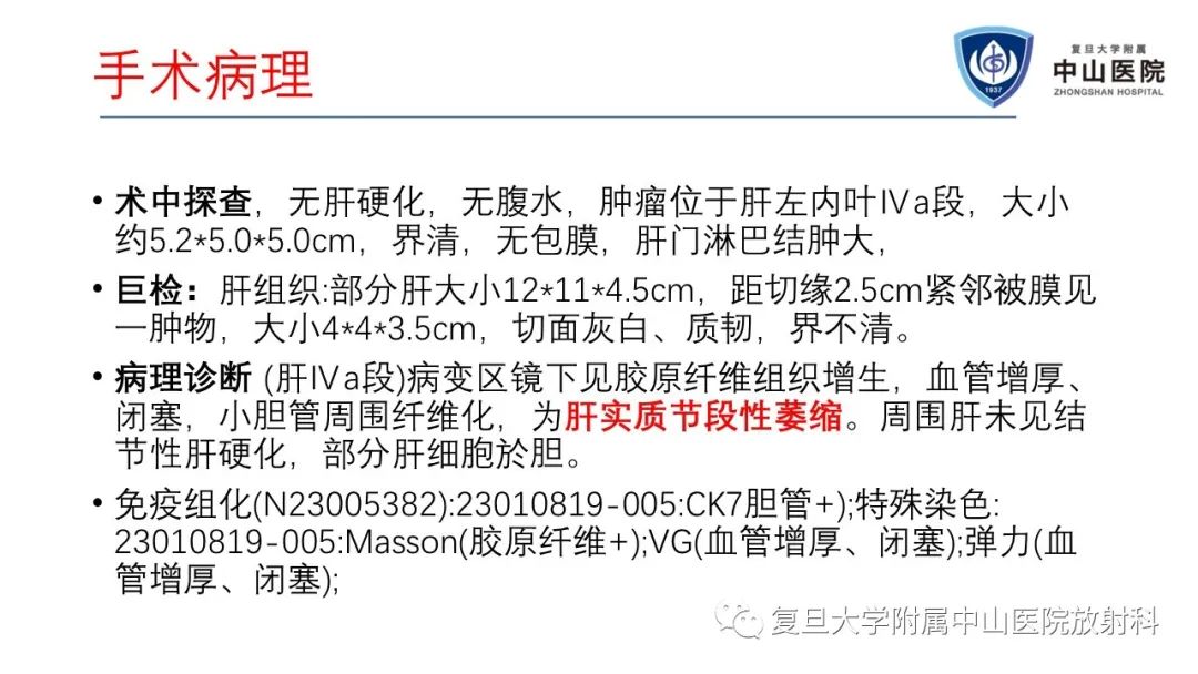 影像PPT - 【病例】肝节段性萎缩1例CT及MR影像-10