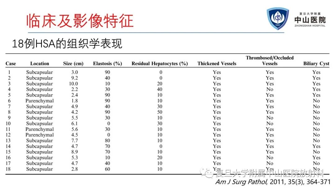 影像PPT - 【病例】肝节段性萎缩1例CT及MR影像-13