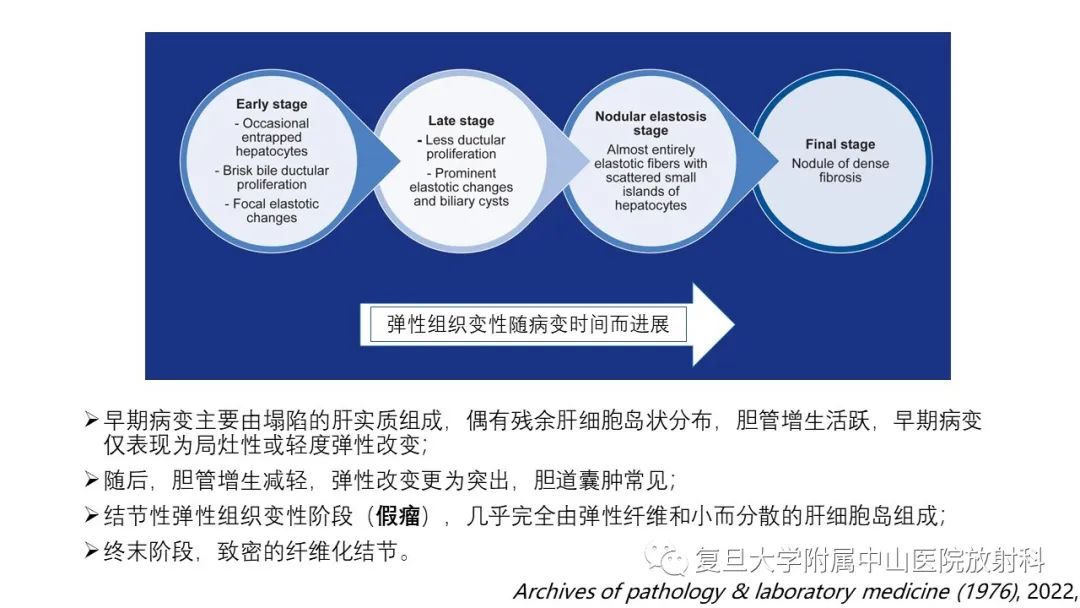 影像PPT - 【病例】肝节段性萎缩1例CT及MR影像-14