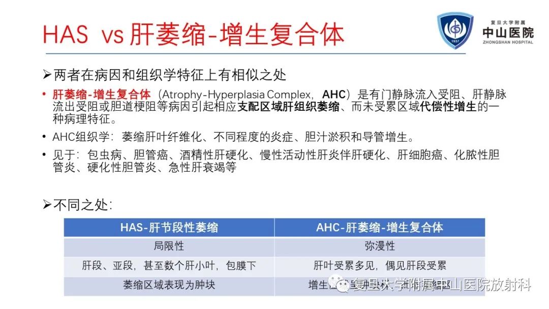 影像PPT - 【病例】肝节段性萎缩1例CT及MR影像-17