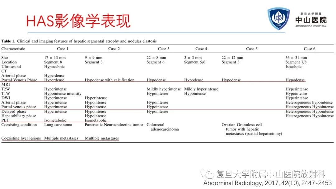 影像PPT - 【病例】肝节段性萎缩1例CT及MR影像-18