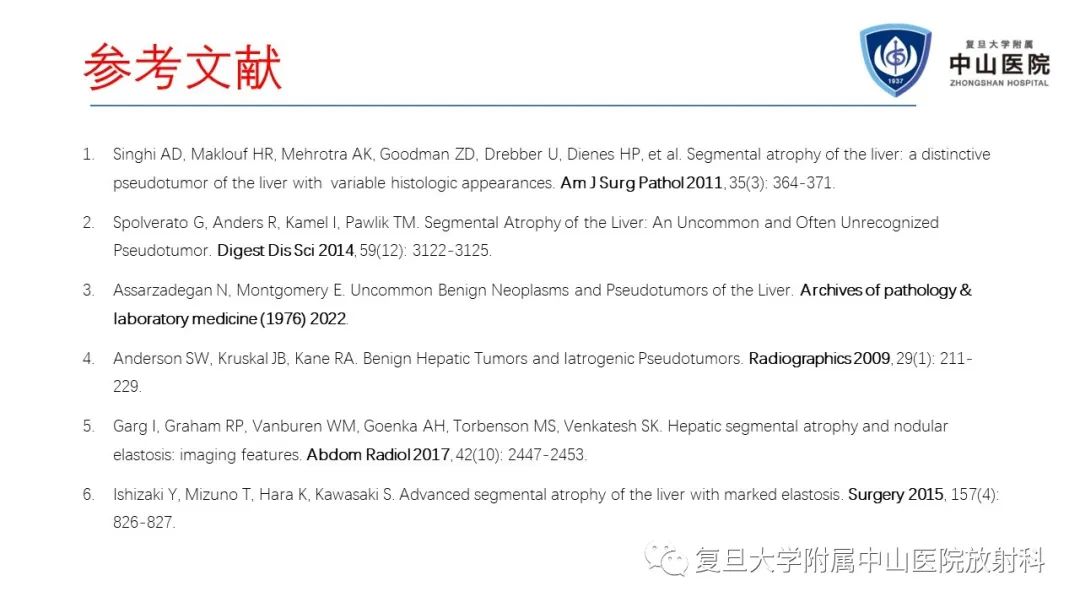 影像PPT - 【病例】肝节段性萎缩1例CT及MR影像-25