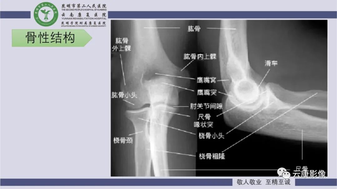 影像PPT - 【PPT】肘关节影像学解剖-4