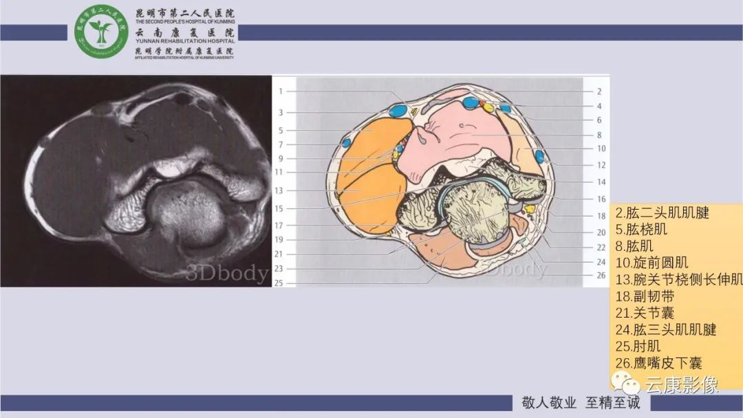 影像PPT - 【PPT】肘关节影像学解剖-8
