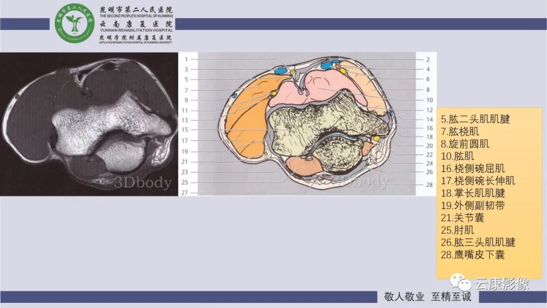 影像PPT - 【PPT】肘关节影像学解剖-9