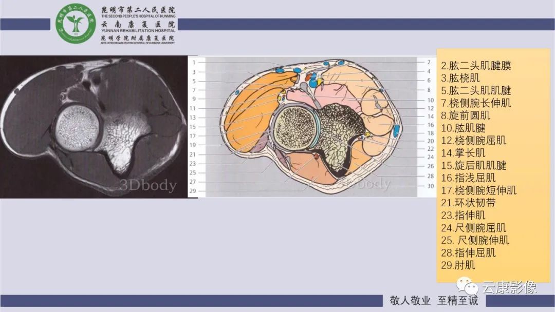 影像PPT - 【PPT】肘关节影像学解剖-10