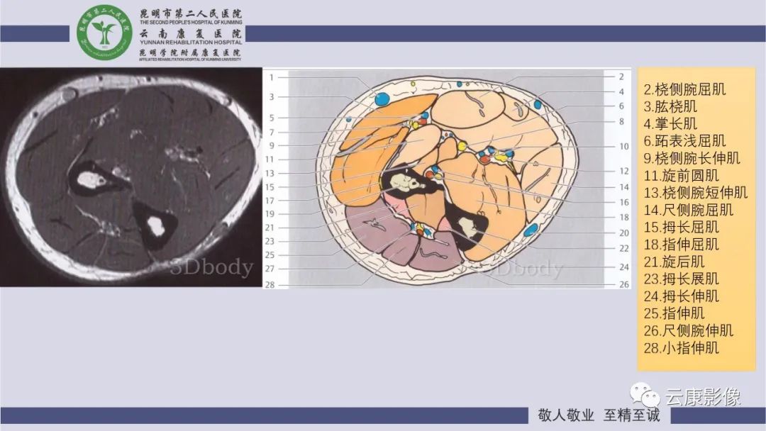 影像PPT - 【PPT】肘关节影像学解剖-12