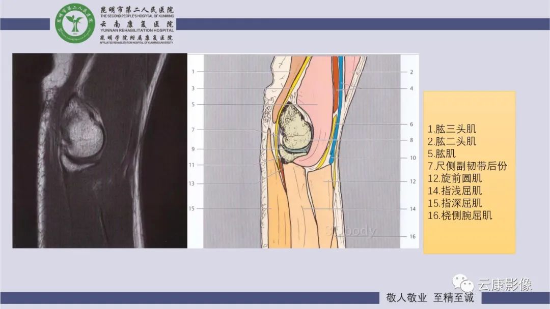 影像PPT - 【PPT】肘关节影像学解剖-13