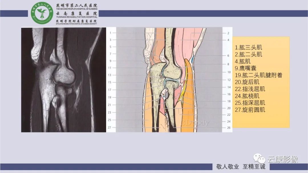 影像PPT - 【PPT】肘关节影像学解剖-15