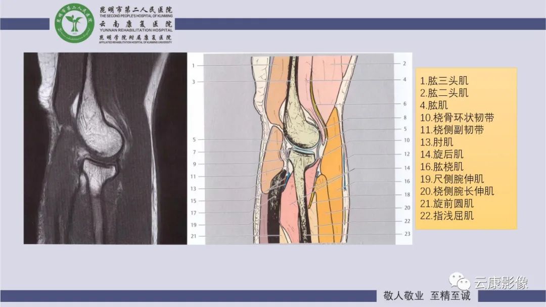 影像PPT - 【PPT】肘关节影像学解剖-16