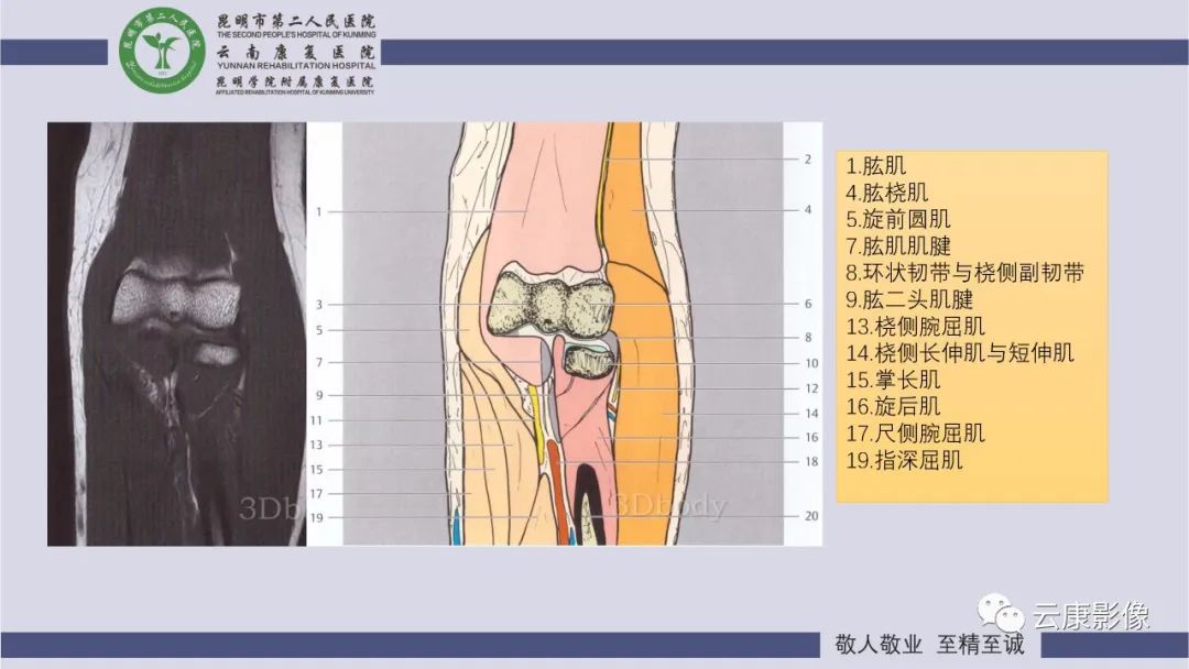 影像PPT - 【PPT】肘关节影像学解剖-17