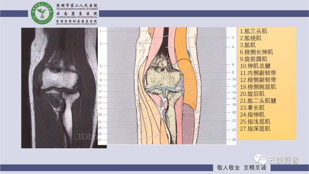 影像PPT - 【PPT】肘关节影像学解剖-18